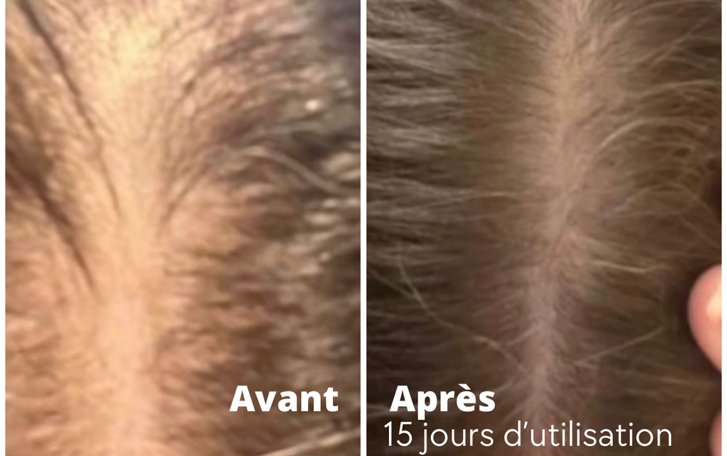 Bpousse Originale